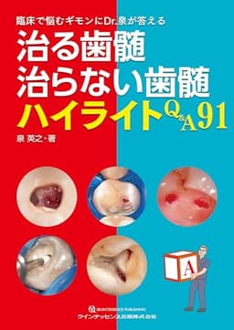 治る歯髄 治らない歯髄 ハイライトQ&A91: 臨床で悩むギモンにDr.泉が答える