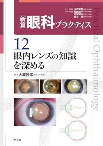 眼内レンズの知識を深める (新篇眼科プラクティス 12)