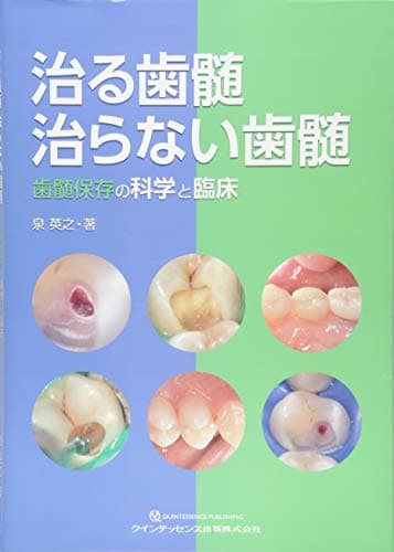 治る歯髄 治らない歯髄