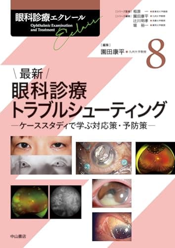 最新 眼科診療トラブルシューティング＜眼科診療エクレール＞