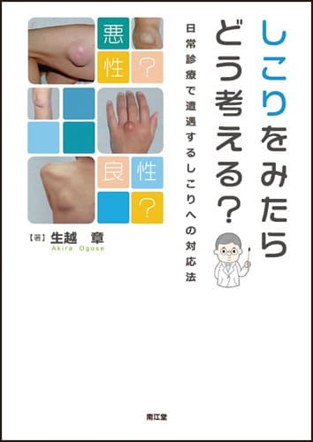 しこりをみたらどう考える?: 日常診療で遭遇するしこりへの対応法