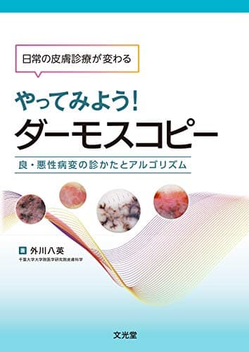 日常の皮膚診療が変わる やってみよう! ダーモスコピー