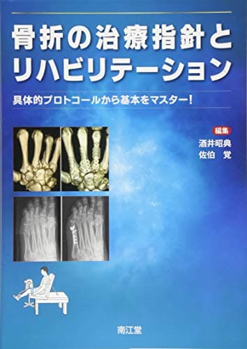 骨折の治療指針とリハビリテーション: 具体的プロトコールから基本をマスター!