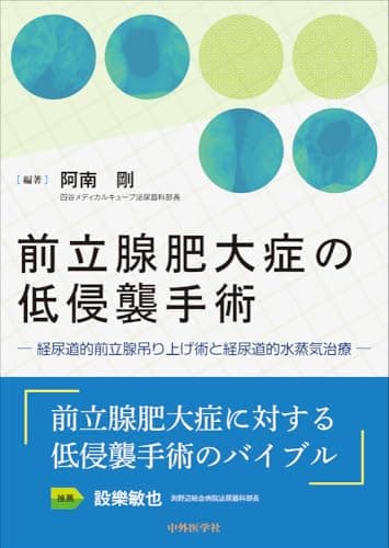 前立腺肥大症の低侵襲手術　―経尿道的前立腺吊り上げ術と経尿道的水蒸気治療―