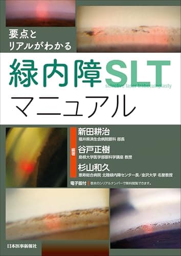 要点とリアルがわかる　緑内障SLTマニュアル