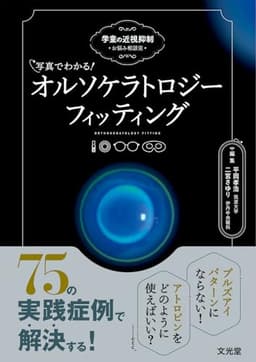 写真でわかる！ オルソケラトロジーフィッティング　学童の近視抑制お悩み相談室