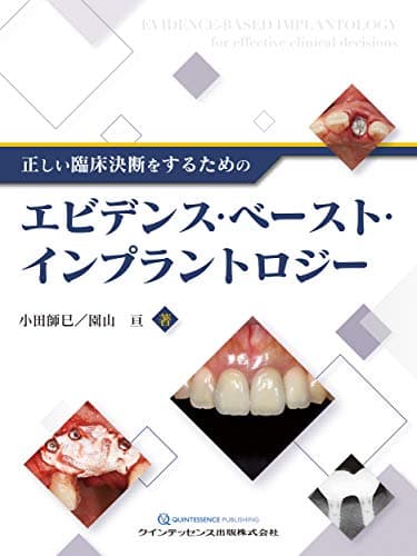 正しい臨床決断をするためのエビデンス・ベースト・インプラントロジー