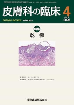 皮膚科の臨床　2026年4月号　乾癬