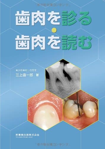 歯肉を診る・歯肉を読む