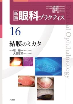 結膜のミカタ　(新篇眼科プラクティス 16)