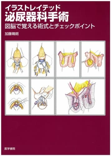 イラストレイテッド泌尿器科手術―図脳で覚える術式とチェックポイント