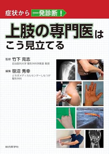 症状から一発診断! 上肢の専門医はこう見立てる