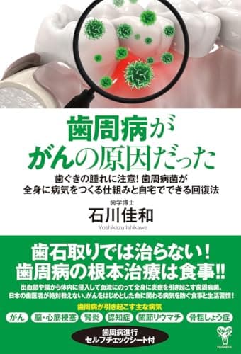 歯周病ががんの原因だった　歯ぐきの腫れに注意！歯周病菌が全身に病気をつくる仕組みと自宅でできる回復法