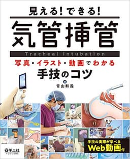 見える！できる！　気管挿管〜写真・イラスト・動画でわかる手技のコツ