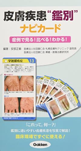 皮膚疾患鑑別ナビカード~症例で見る! 比べる! わかる! ~ ([実用品])