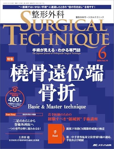 整形外科サージカルテクニック 2024年6号〈特集〉橈骨遠位端骨折（第14巻6号）