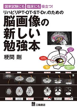 国家試験にも臨床にも役立つ ! リハビリPT・OT・ST・Dr.のための脳画像の新しい勉強本
