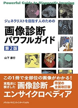 ジェネラリストを目指す人のための 画像診断パワフルガイド 第2版