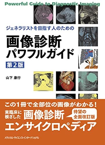 ジェネラリストを目指す人のための 画像診断パワフルガイド 第2版
