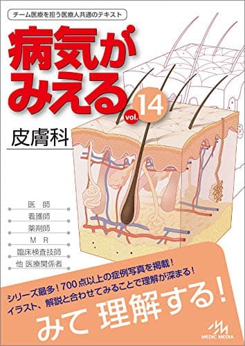 病気がみえる vol.14 皮膚科 第1版