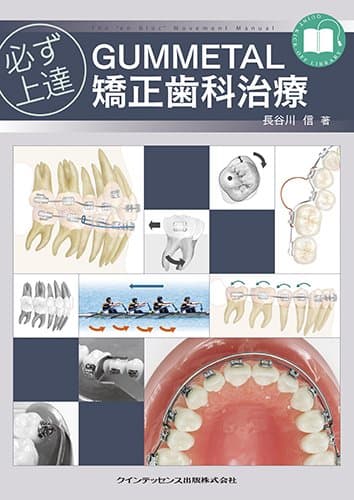 必ず上達 GUMMETAL 矯正歯科治療 (必ず上達シリーズ)