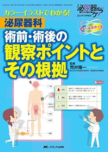 泌尿器科術前・術後の観察ポイントとその根拠: カラーイラストでわかる!
