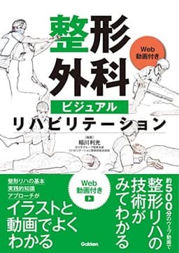 整形外科ビジュアルリハビリテーション