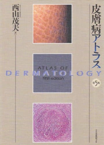 皮膚病アトラス