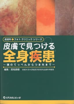 皮膚で見つける全身疾患 (皮膚科フォトクリニックシリーズ)