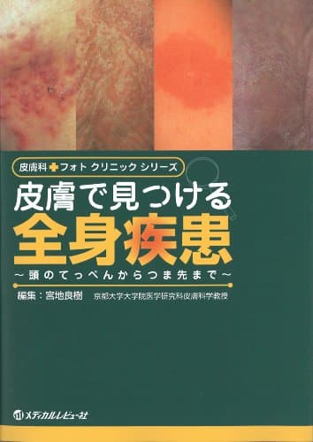皮膚で見つける全身疾患 (皮膚科フォトクリニックシリーズ)