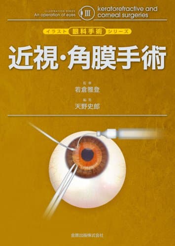 近視・角膜手術 (イラスト眼科手術シリーズ 3)