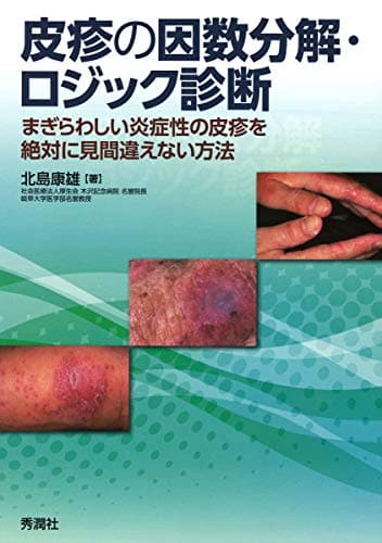 皮疹の因数分解・ロジック診断
