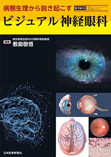 病態生理から説き起こす　ビジュアル神経眼科 -電子版付-