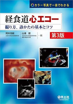 カラー写真で一目でわかる 経食道心エコー 第3版〜撮り方、診かたの基本とコツ