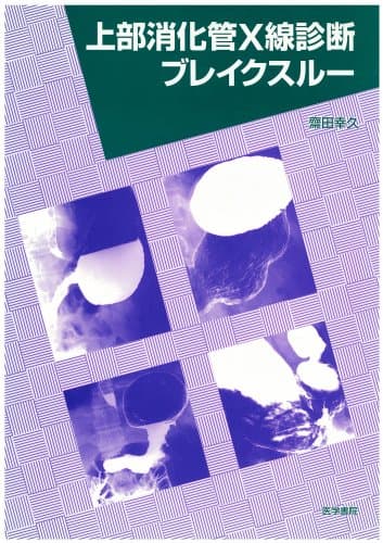 上部消化管X線診断ブレイクスルー