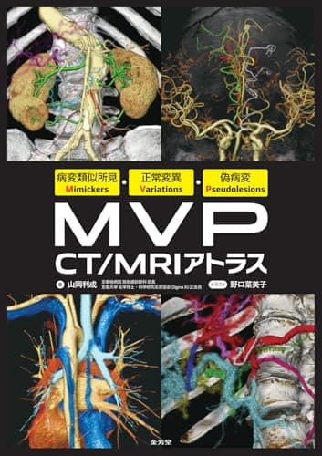 病変類似所見Mimickers・正常変異Variations・偽病変Pseudolesions MVP CT/MRIアトラス